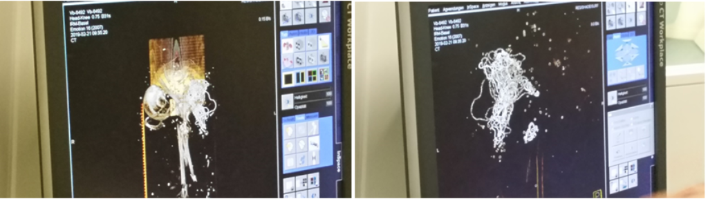 Wieder sind zwei Fotos zu sehen: Links zeigt ein Bildschirm ein Skelett mit Schmuck, rechts ist auf einem Bildschirm nur der Schmuck zu sehen
