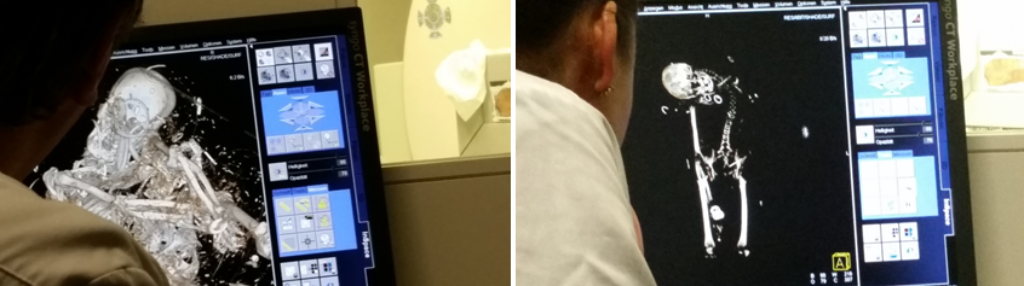 Erneut sind zwei Fotos zu sehen: Links ein Monitor, auf dem der ganze Inhalt der Schachtel zu sehen ist, rechts nur Teile des Skeletts
